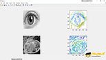 رسم مرزهای یک تصویر با استفاده از دستور imcontour در نرم افزار متلب 2018 (MATHWORKS MATLAB R2018A V9.4)